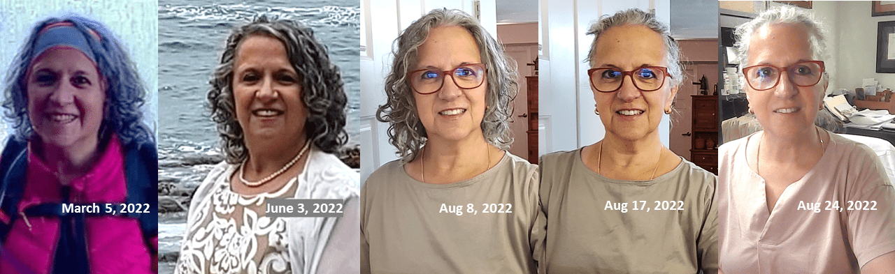 Visual collage from after losing 55 pounds to hypothyroidism, to resolution