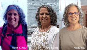 Post weightloss, profound hypothyroidism, 3 months on thyroid medication