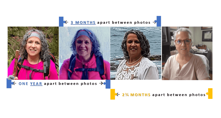 Collage after weight loss, just before becoming profoundly hypothyroid, being profoundly hypothyroid, after starting thyroid medication