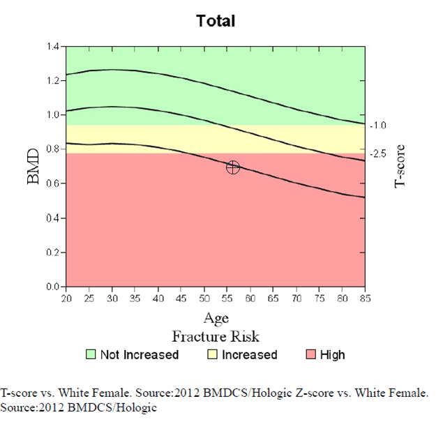 "Bone Mineral Density" based on a DEXA Whole Body Scan