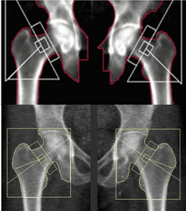 bone density images - clinical versus retail