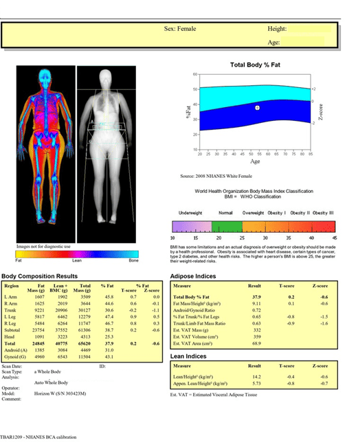 Body Fat Composition and Total Lean Body Mass (muscle) plus bone